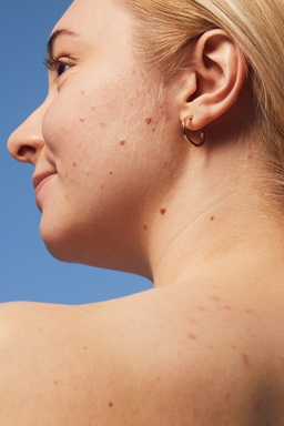 young woman using NIVEA Derma Skin Exfoliator