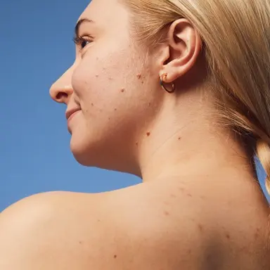 young woman using NIVEA Derma Skin Exfoliator