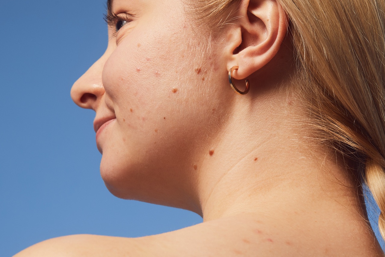 young woman using Nivea Derma Skin Exfoliator