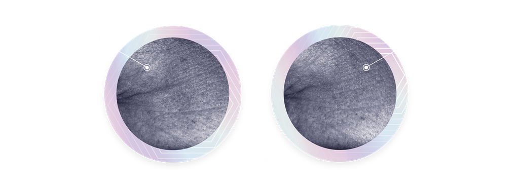 A before and after image compares a pair of images of crow's-feet wrinkles next to the text, "Reverse the signs of Ageing in 2 weeks".