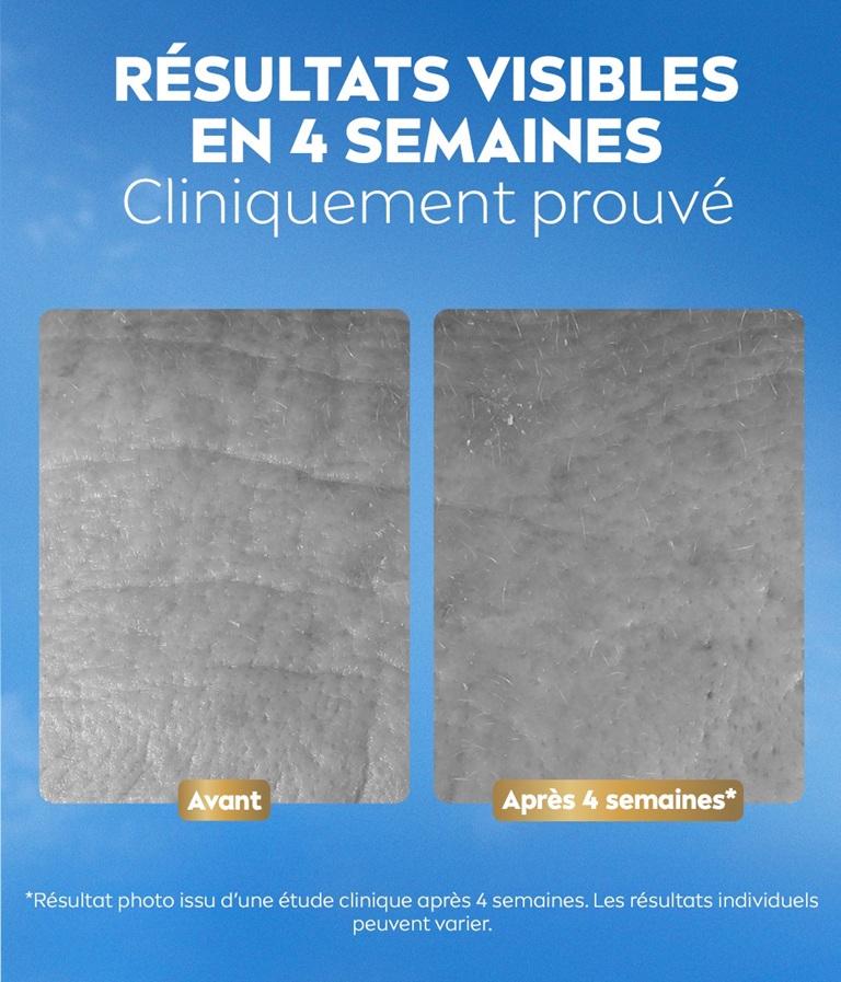 Photo comparative avant/après des résultats sur la peau, avec le texte « Hydratation intense pendant 72 h ».