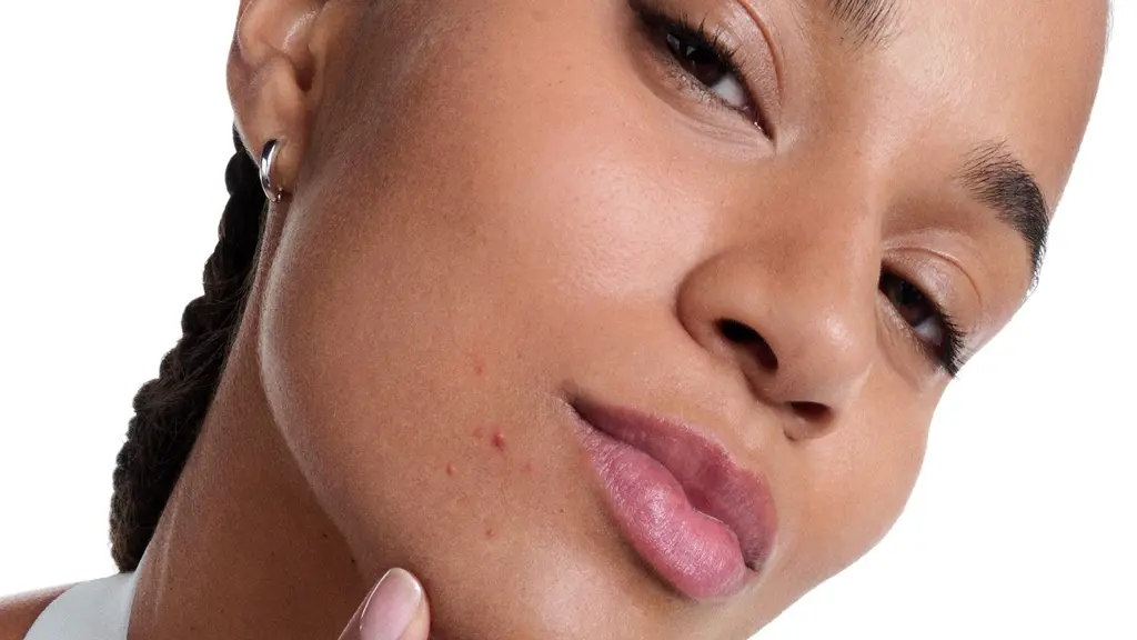 Close-up of a woman with facial blemishes touching her chin