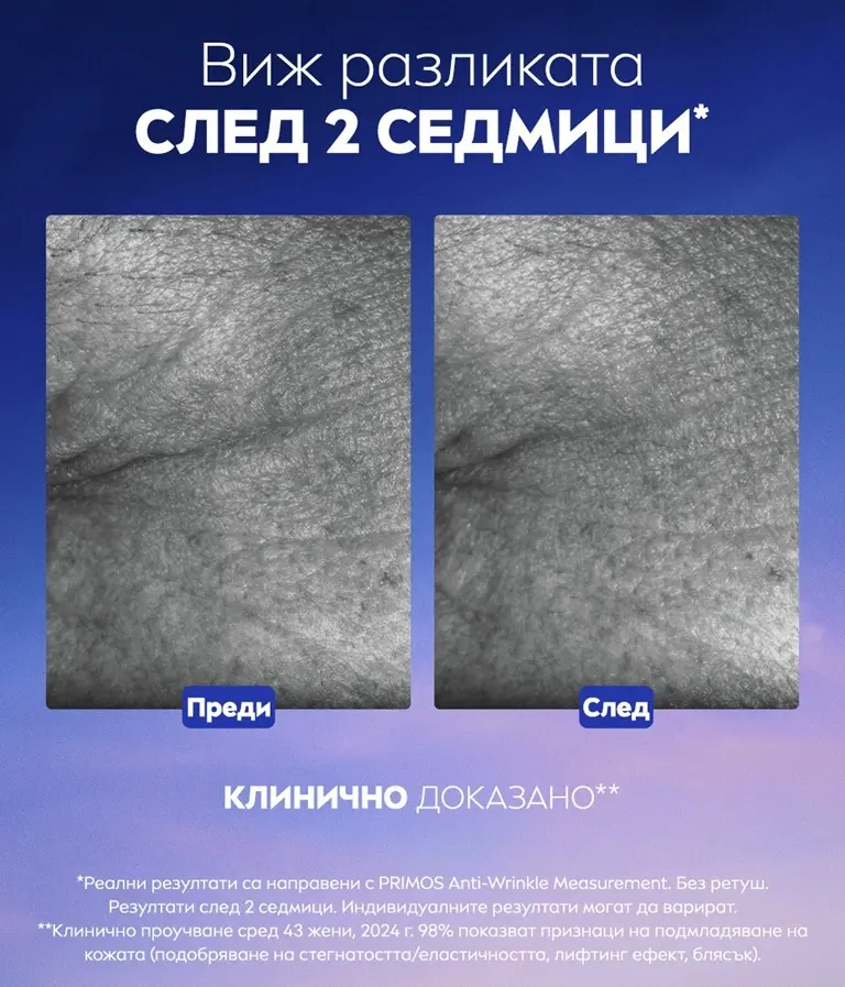 A before and after image compares a pair of images of crow's-feet wrinkles next to the text, "See the difference in 2 weeks".