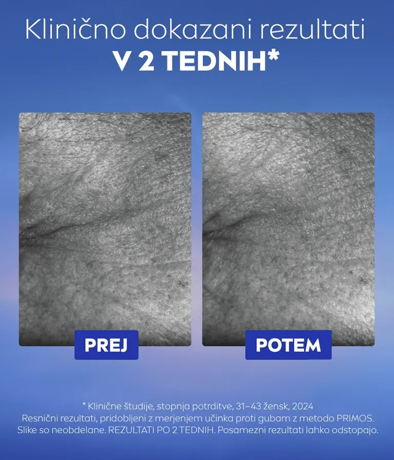Neposredna primerjava črno-belih slik gubic okrog oči.