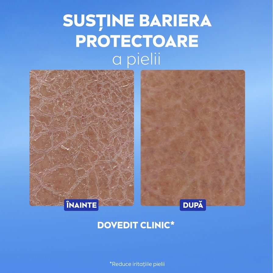 NIVEA Repair & Care Body Serum Lotion benefits include 72h+ intensive moisture and repairs 5 signs of dry skin* from 1st use