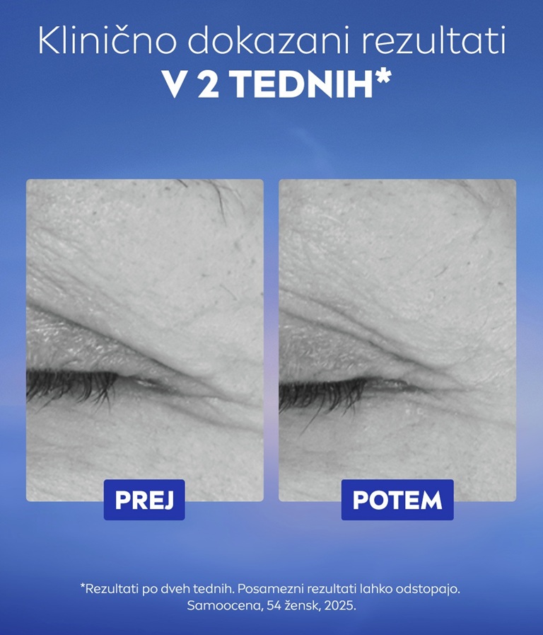 Neposredna primerjava črno-belih slik gubic okrog oči.