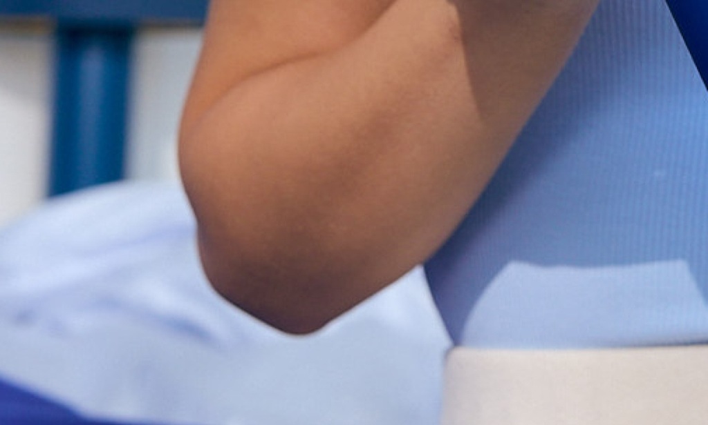 A woman's elbow