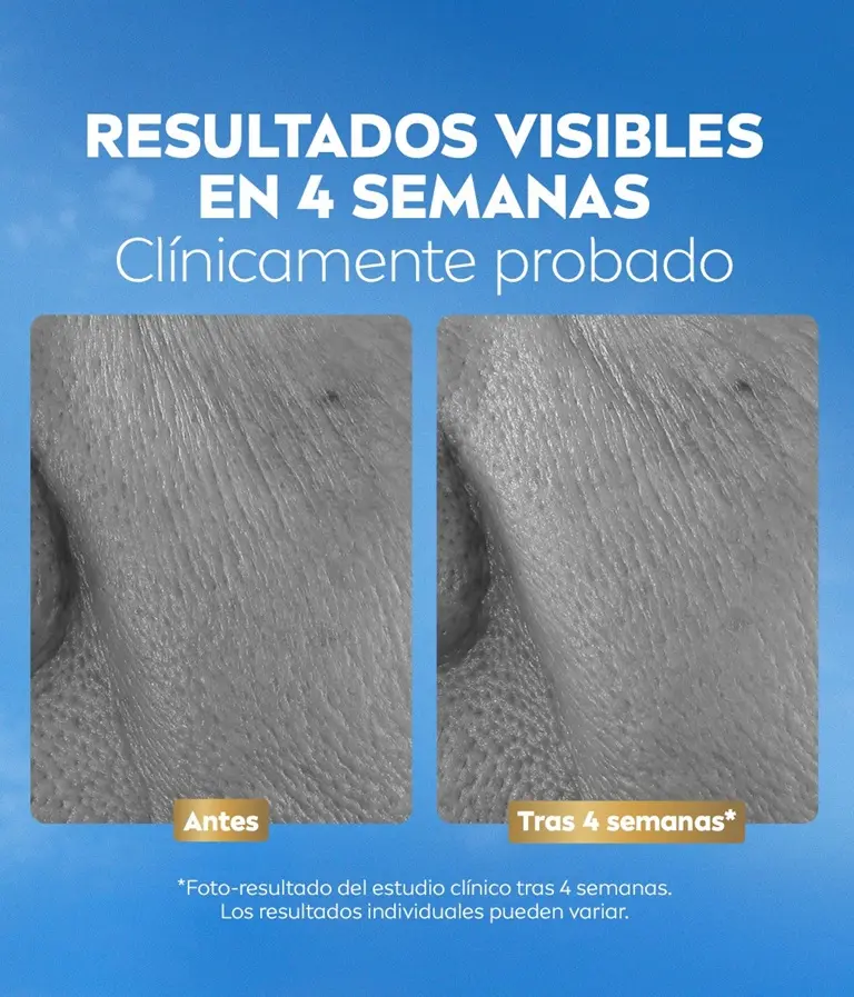 Fotografía comparativa de la piel (antes y después), con el texto: «Resultados visibles en 4 semanas».
