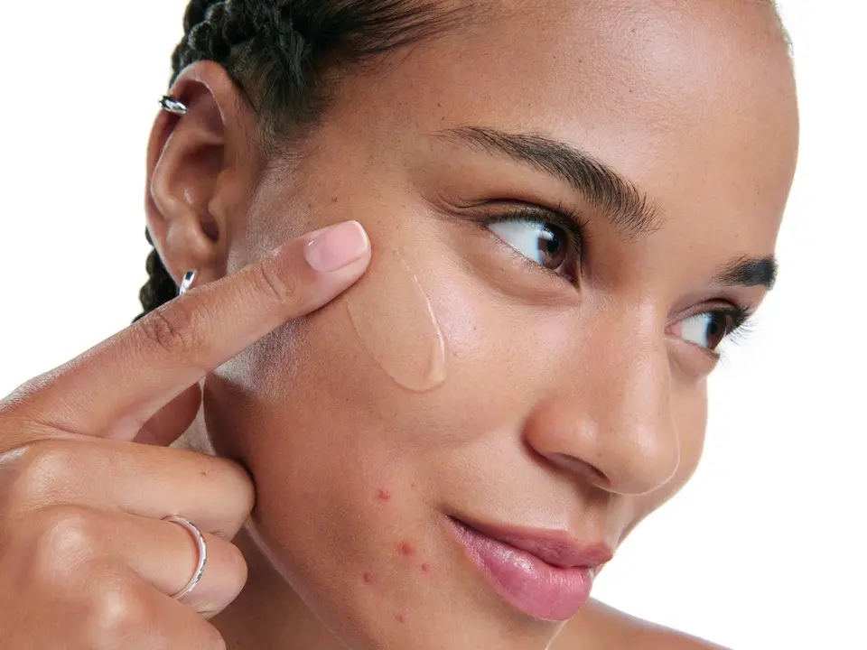 Woman applying Eucerin Probiom8 product to blemished, acne-prone skin