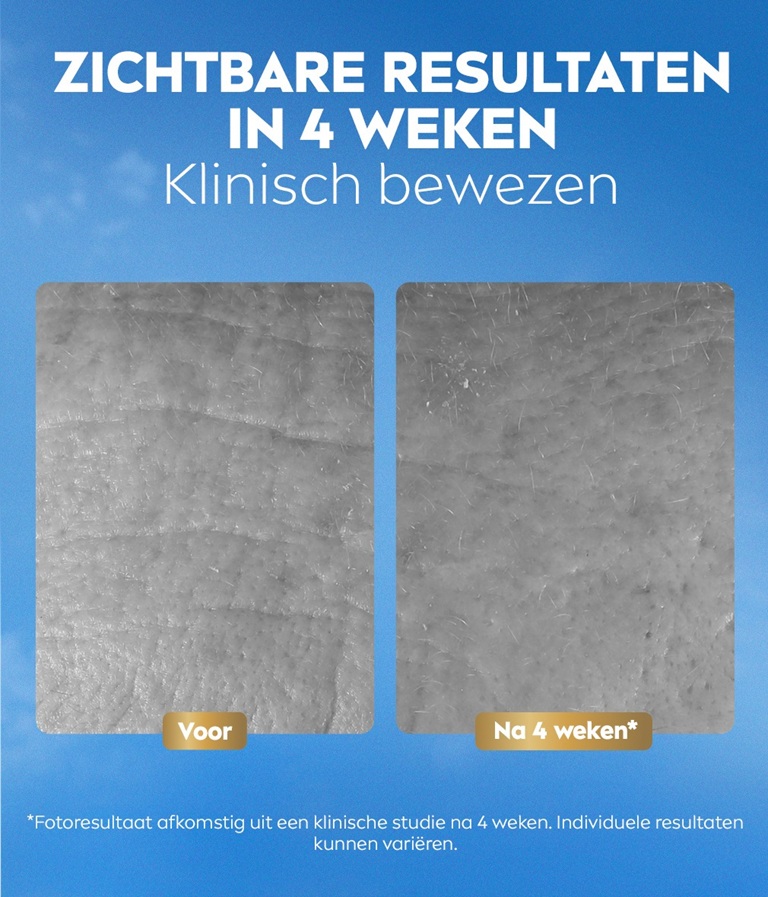 Vergelijkende voor- en nafoto van huidresultaten, met de tekst “72 u diepe hydratatie”.
