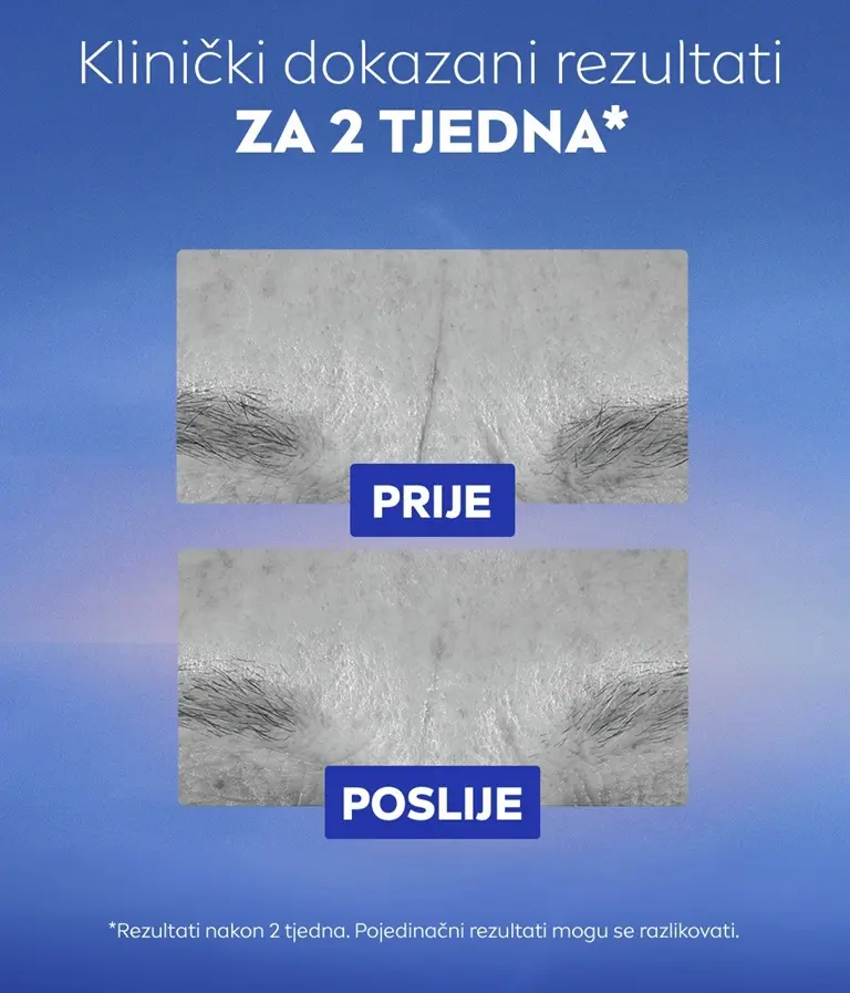 Usporedba crno-bijelih slika bora između obrva.