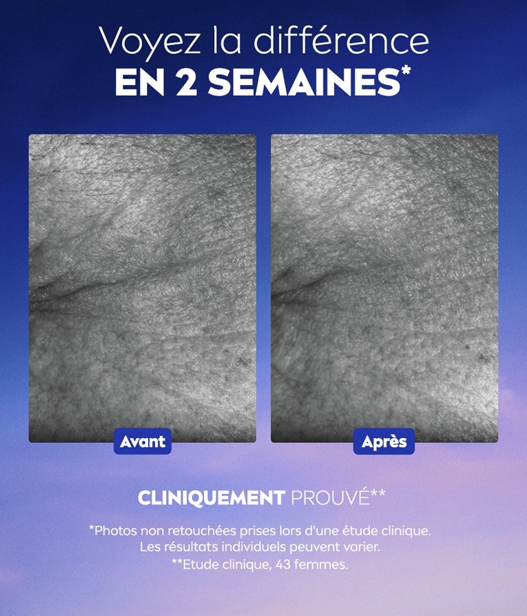 Une image avant/après compare deux photos des rides du coin des yeux, à côté du texte : « Voyez la différence en 2 semaines».