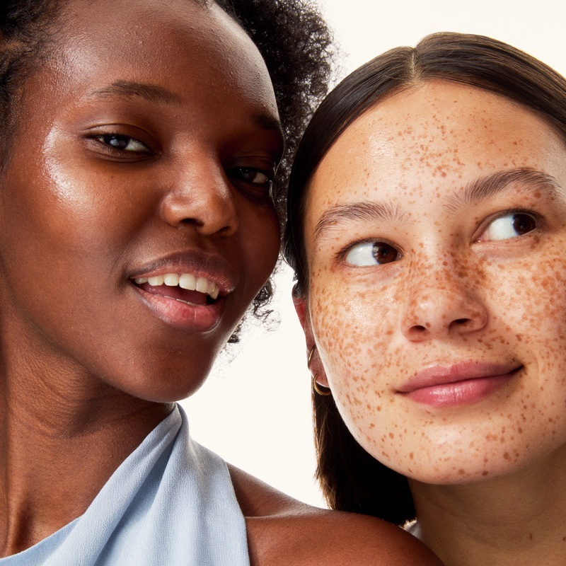 two young girls one with sun spot