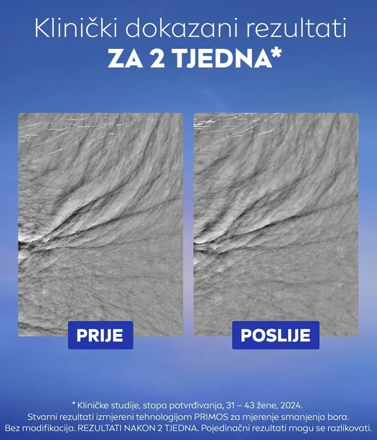 Usporedba crno-bijelih slika bora oko očiju.