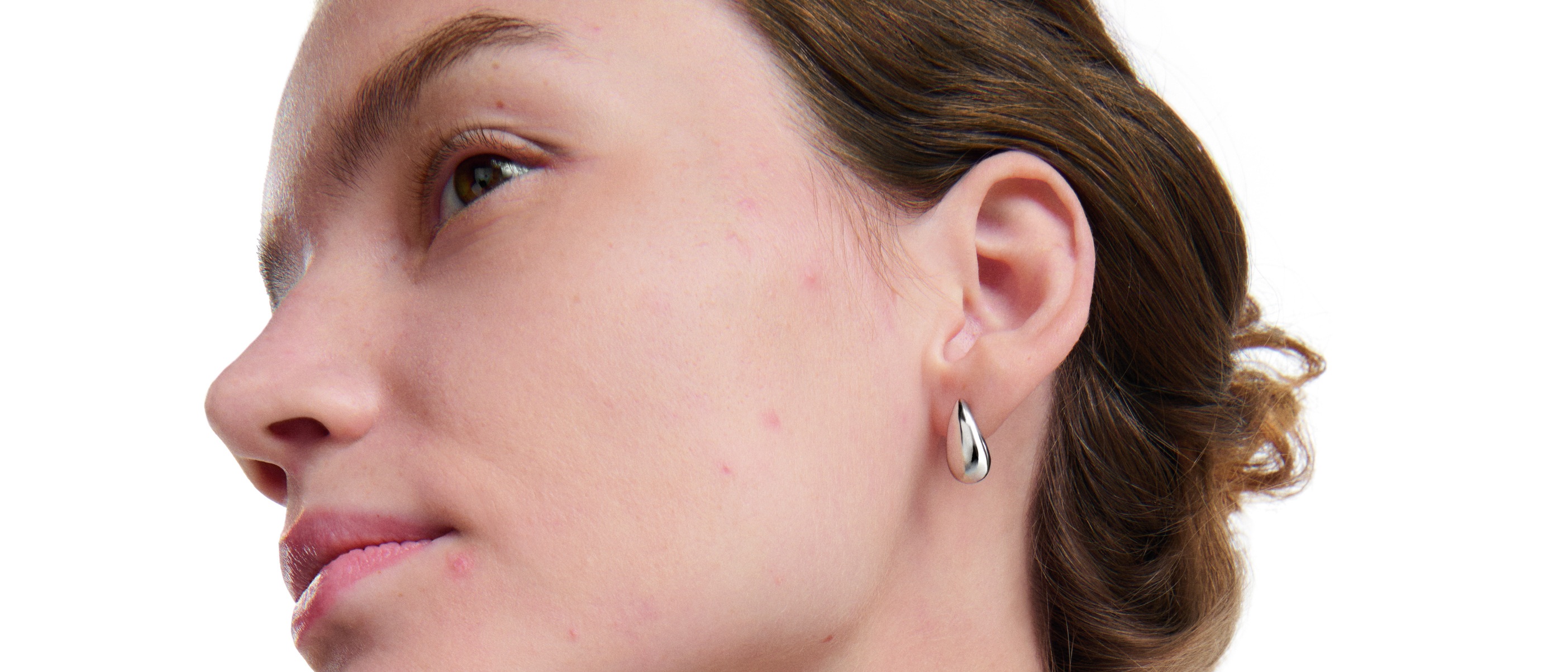 Mujer con piel con tendencia acneica e imperfecciones leves