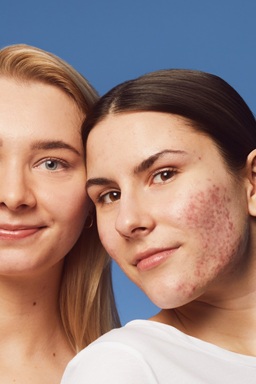 young woman using NIVEA Derma Skin Exfoliator