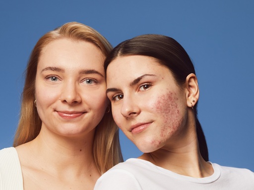 young woman using NIVEA Derma Skin Exfoliator
