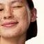 smiling Girl with sun spots