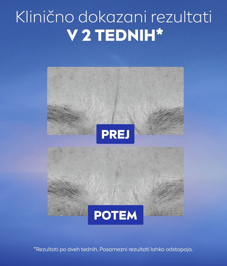 Neposredna primerjava črno-belih slik gubic med obrvmi.