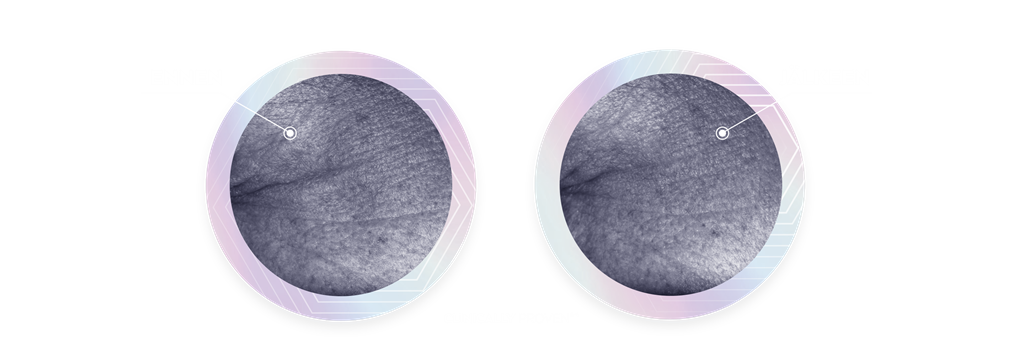 Ennen ja jälkeen kuvat vertaavat silmänympärysryppyjä "Käännä ikääntymisen merkkejä taaksepäin 2 viikossa"-tekstin vieressä.