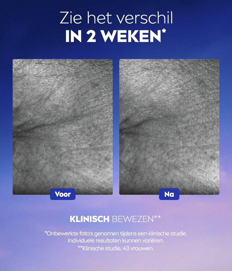 Een voor en na afbeelding vergelijkt de kraaienpootjes naast de tekst: "Zie het verschil vanaf 2 weken"