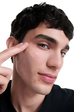 Man applying Eucerin Probiom8 product to blemished, acne-prone skin