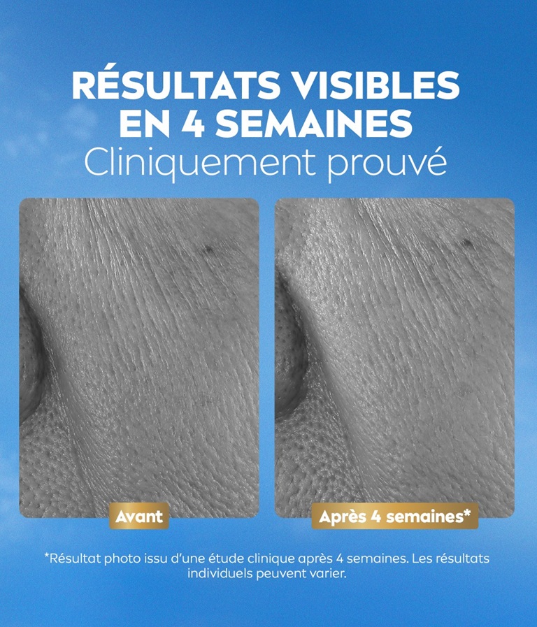 Photo comparative en gros plan de la peau, avant et après, avec le texte « Résultats visibles en 4 semaines ».